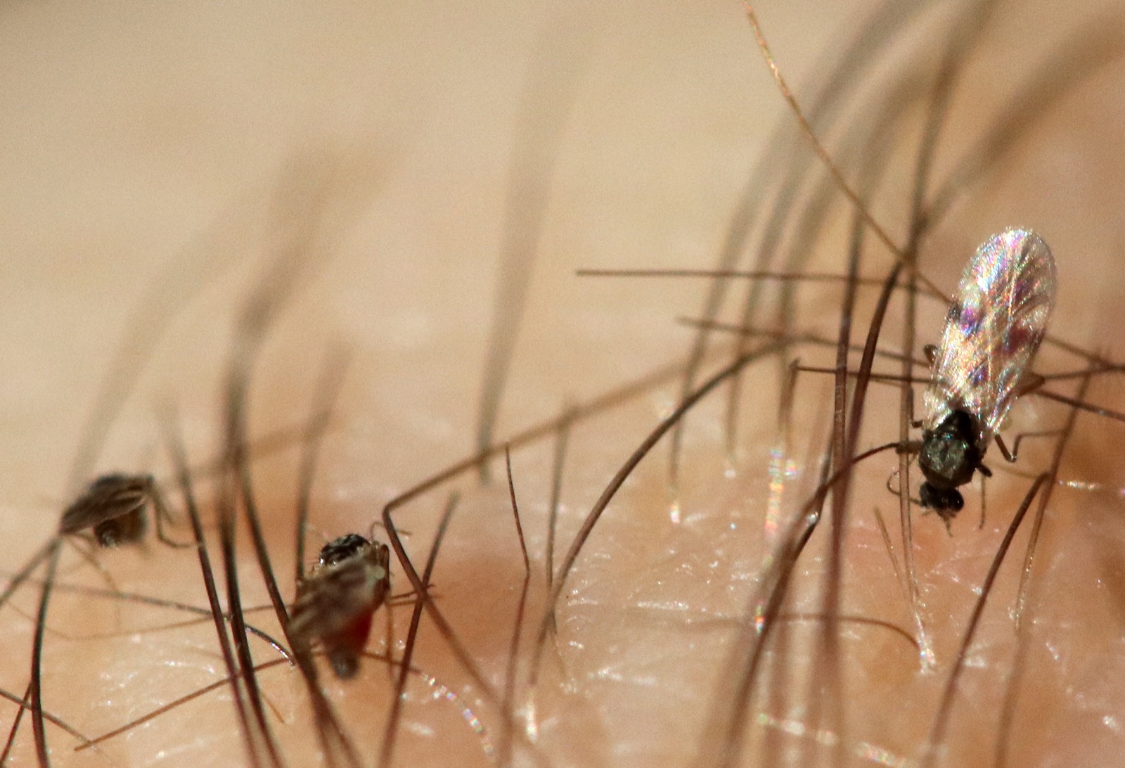 Jejenes del género Culicoides picando la piel de una persona; estos insectos transmiten el virus Shamonda al ganado.